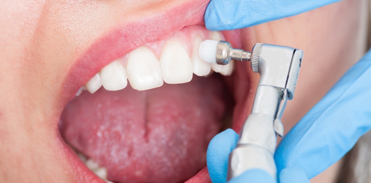 Der Schlüssel zum Erfolg in der Prophylaxe – ZWP online – das